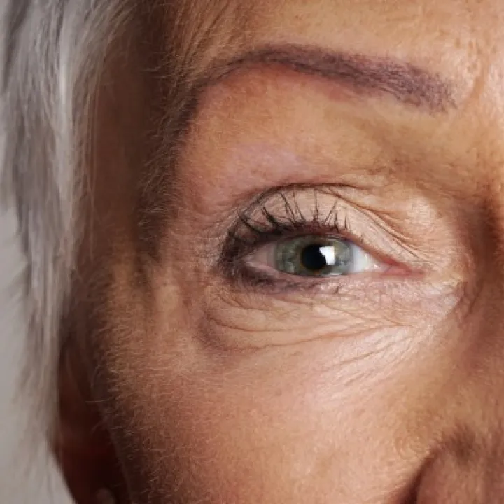 peau mature avec rides apparentes